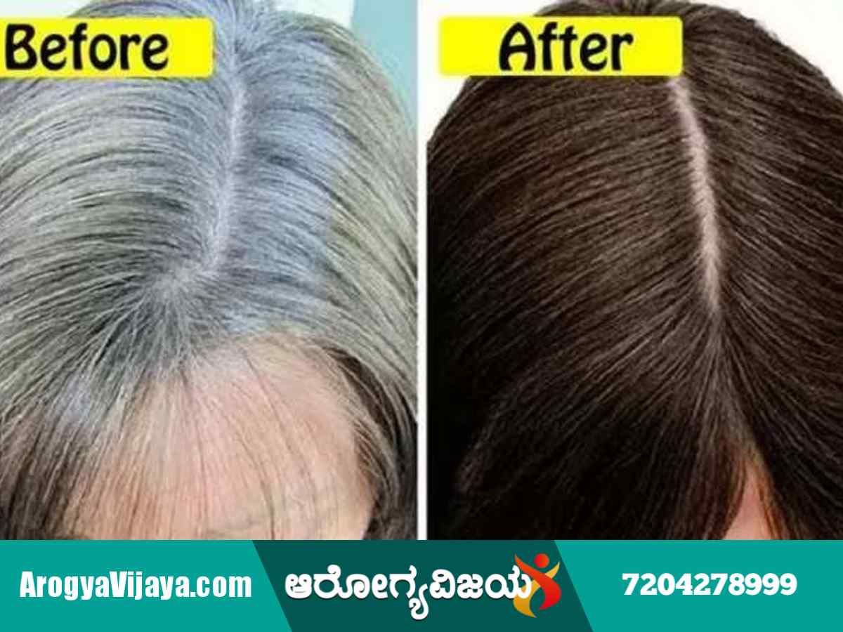 Learn how to turn white hair black